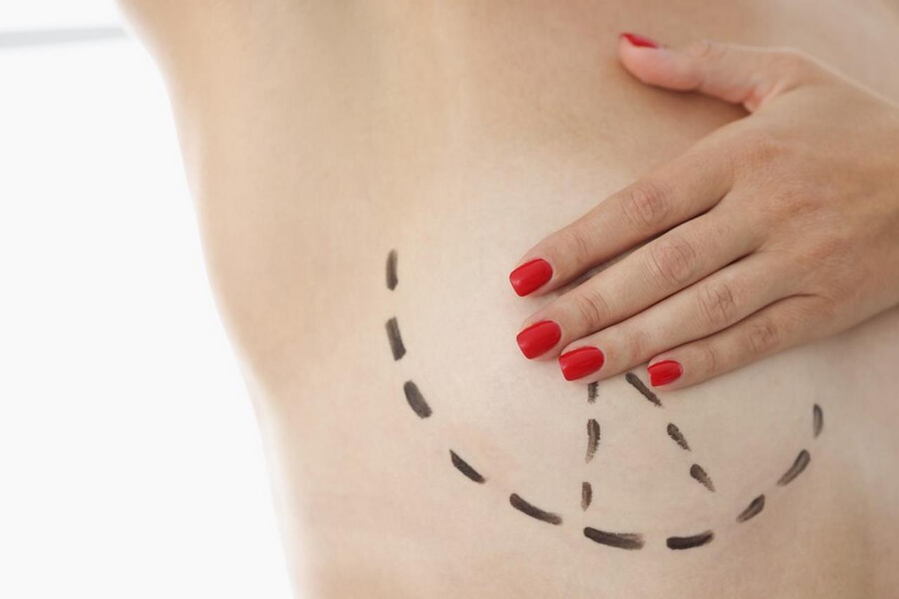 Jakie rozmiary implantów piersi istnieją dla zabiegu powiększania piersi?